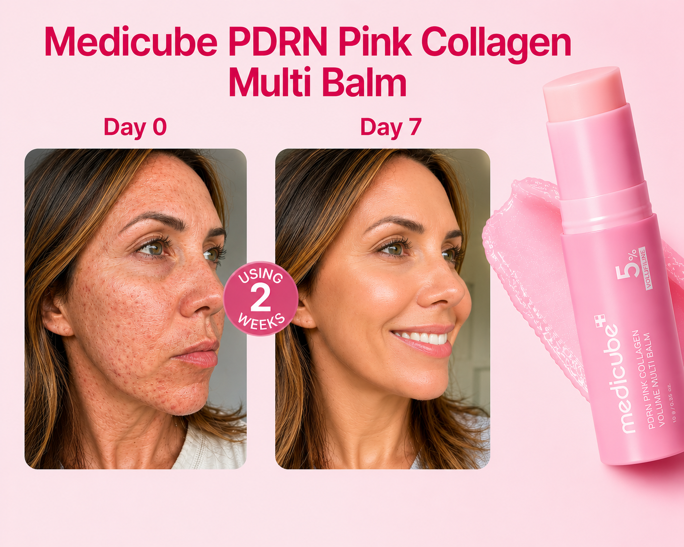 MEDICUBE PDRN PINK COLLAGEN MULTI BALM STICK 5% VOLUFILINE