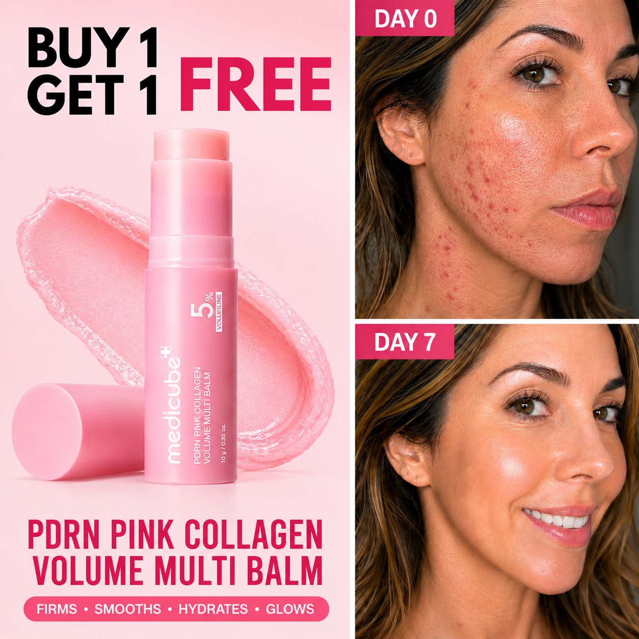 MEDICUBE PDRN PINK COLLAGEN MULTI BALM STICK 5% VOLUFILINE